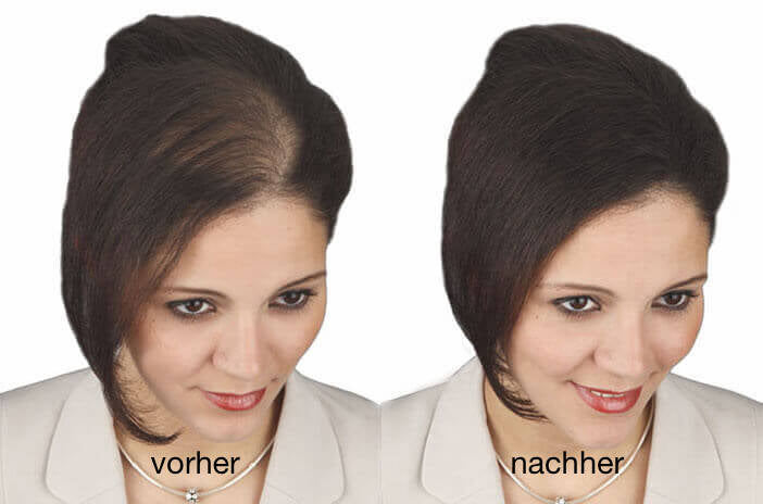 Super Million Hair - Schütthaar Haarfasern Default Title variant detail image - ed1fd475b8cc6880a608439ba51ad7145bb48b123b123ef4573935b2bf9cef4a